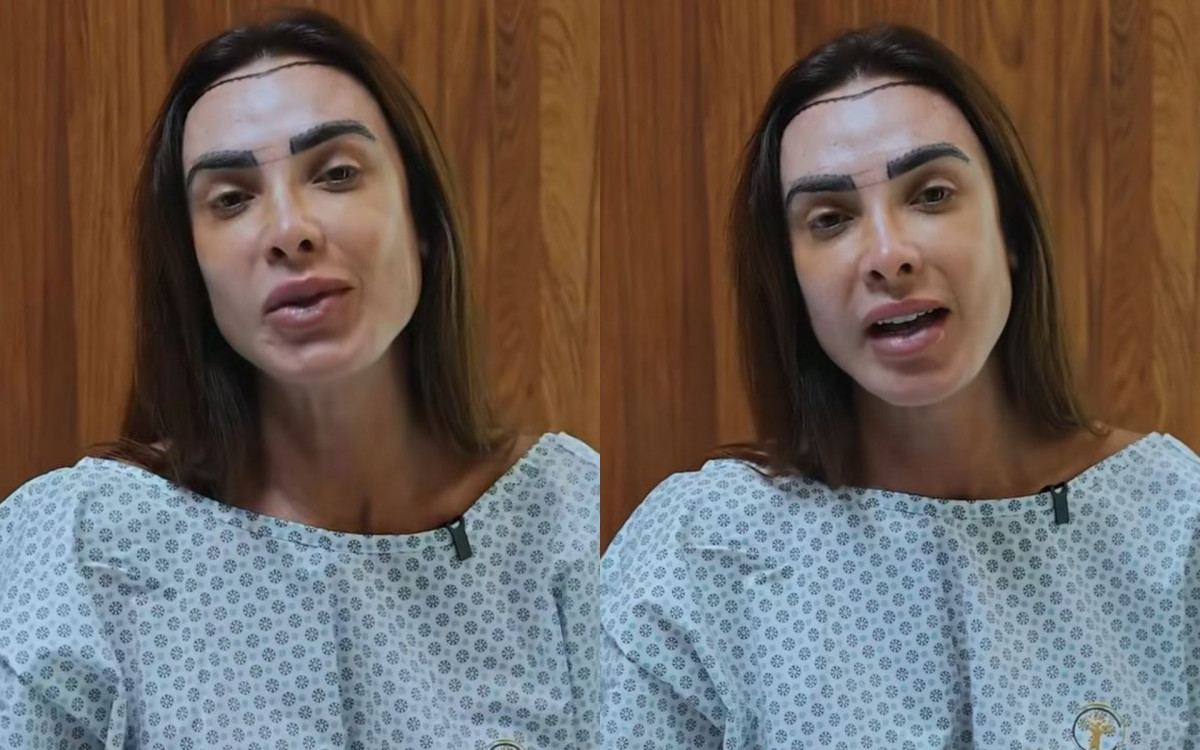 Nicole Bahls revela motivo de transplante capilar